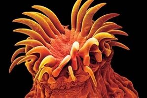 انگل ترماتود در انسان