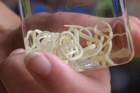 انگل های بدن انسان